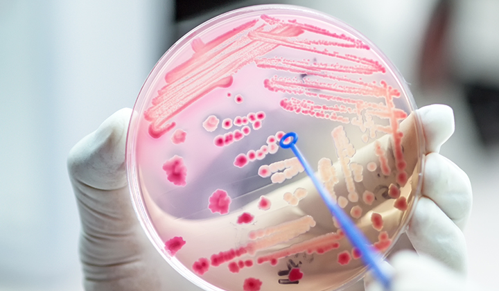 Der Darmflora-Aufbau nach Antibiotika ist häufig nötig